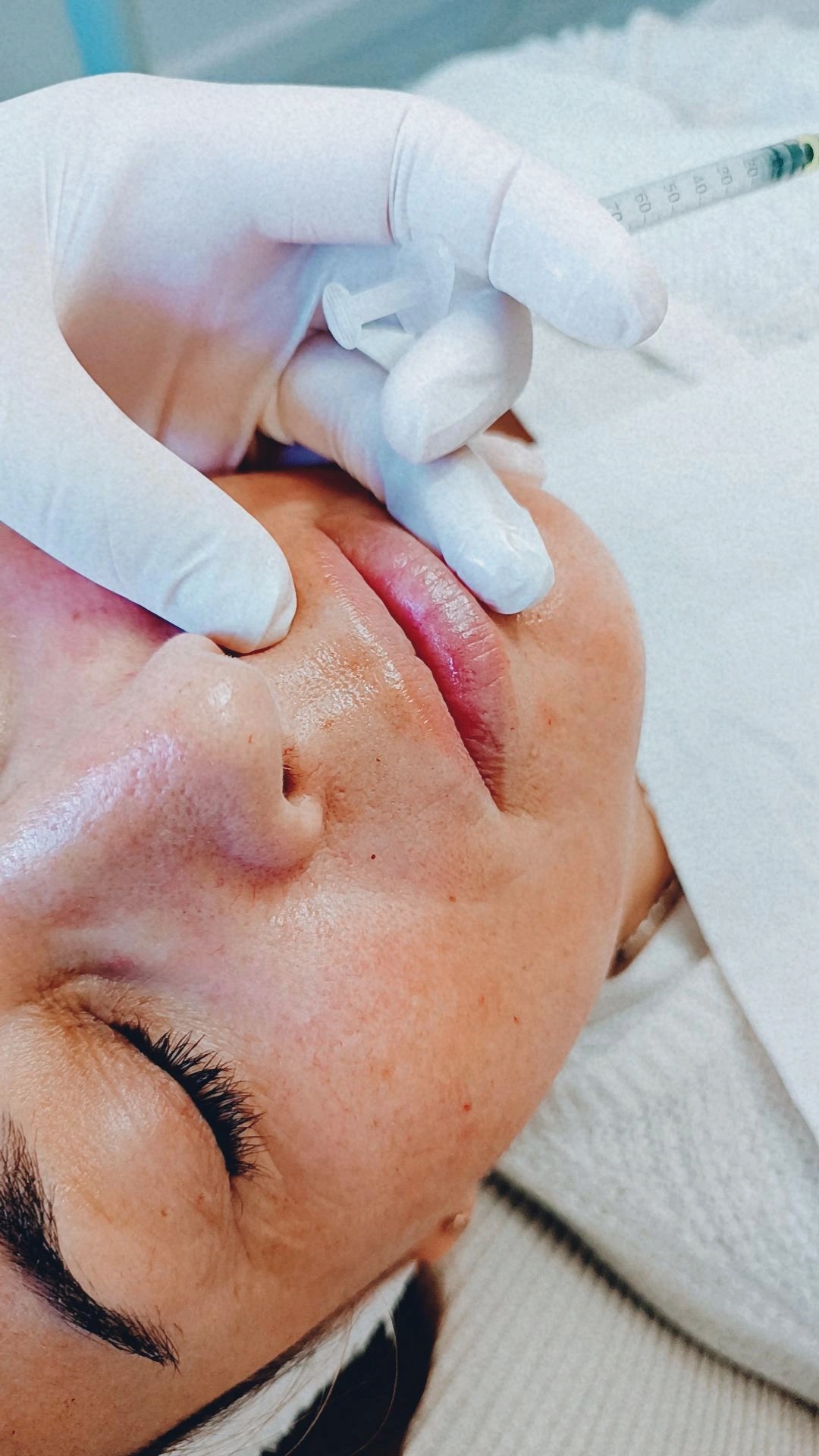 Tratamiento facial en proceso